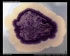 chromobacterium and erwinia